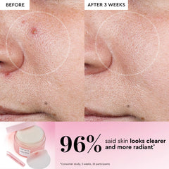 Korean Toner Pad Multi-Masking Kit
